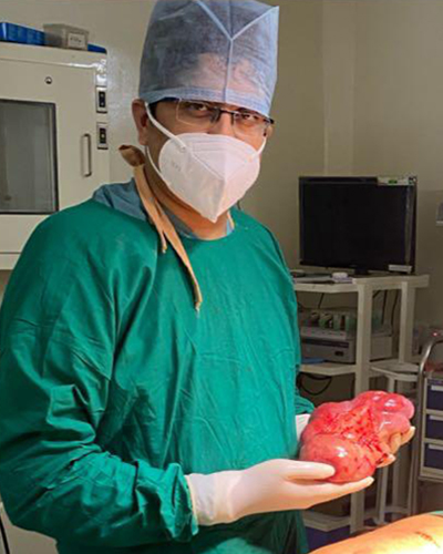 Surgeon holding organ